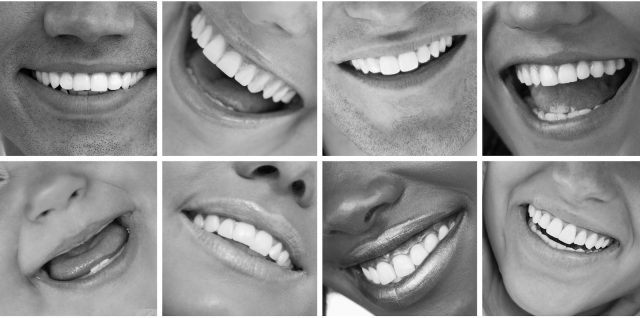 santé dentaire : de belles dents saines